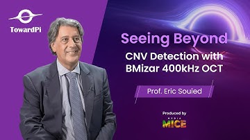 Seeing Beyond: Prof. Eric Souied on CNV Detection with BMizar 400kHz OCT