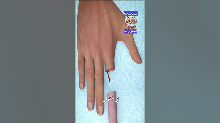 هل يمكن إعادة إصبع مقطوع؟ 🤔