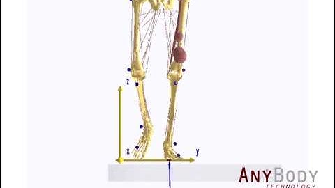 AnyBody Example: Medical/Rehab: Gait Analysis.