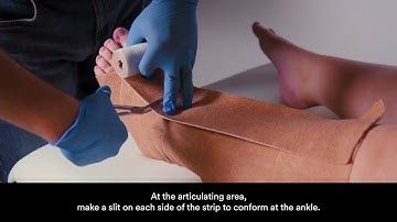 Compression System Application Video. Thin, fragile leg.
