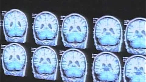 Brain Scans Find Consciousness in Some 'Vegetative' Patients