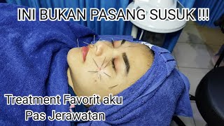 JERAWAT HILANG !! hanya dengan akupuntur | cara meredakan jerawat screenshot 5