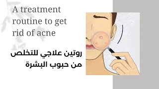 العلاج المثالي للتخلص من الحبوب تحت الجلد|The perfect treatment to get rid of pimples under the skin