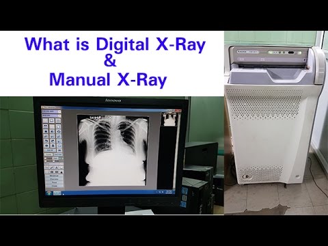 What Is Digital X Ray Manual X Ray Youtube