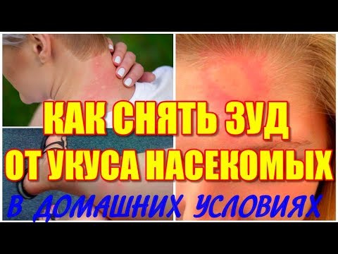 Как снять в домашних условиях зуд после укуса насекомых