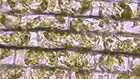 Plasmolysis of Elodea cells