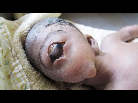 Video: 10 Most Incredible Medical Cases - Alternative View