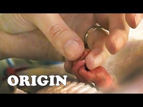 Sich um die kleinsten Babys kümmern | Zu früh geboren documentary thumbnail