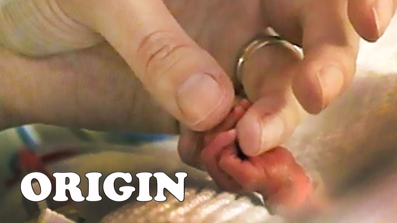 Caring For The Smallest Babies | Born Too Soon