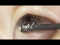 【耳掃除】#155 〜粘着綿棒➡綿棒➡カメラ//奥のカタマリを根こそぎ取りたい‼️〜 earwax