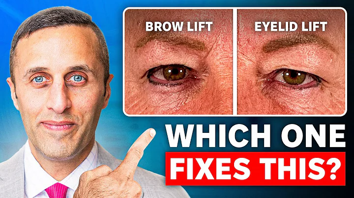 Brow Lift or Eyelid Lift: Which do YOU Need?