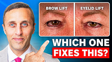 Brow Lift or Eyelid Lift: Which do YOU Need?