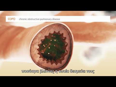 Βίντεο: Μπορεί να θεραπευτεί η ιδιοπαθής πνευμονική ίνωση;