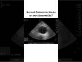 Ultrasound Quiz? Wait for the answer #ultrasound #MRI #Xray #theradiologylens #india #ctscan
