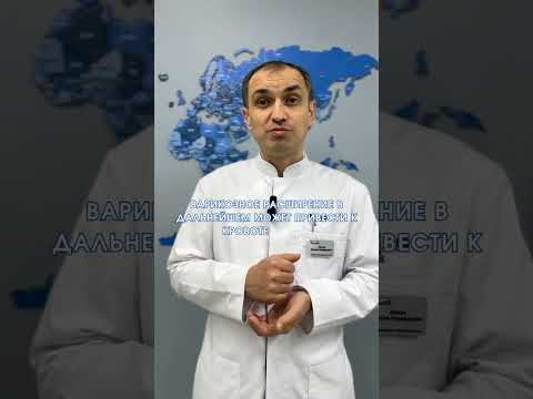 Сосудистые звездочки опасны?  #флебологмосква