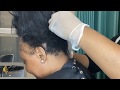 Traction alopecia | Relaxer cut and style