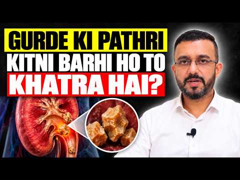 Gurde Ki Pathri Gurda Kaise Kharab Karti Hai? - Kidney Stone Symptoms & Laser Treatment thumbnail image