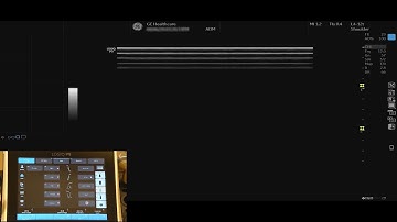 LOGIQ P9 Tutorials: My Trainer Plus