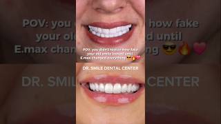 POV: You got Emax Veneers 😎🔥❤️ #emaxveneers #expert #dentistry#viral #shorts