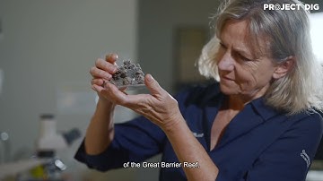 Scanning electron microscope | Project DIG