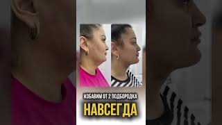 Эндолифт – вашу путь к идеальному и четкому овалу лица 🤯