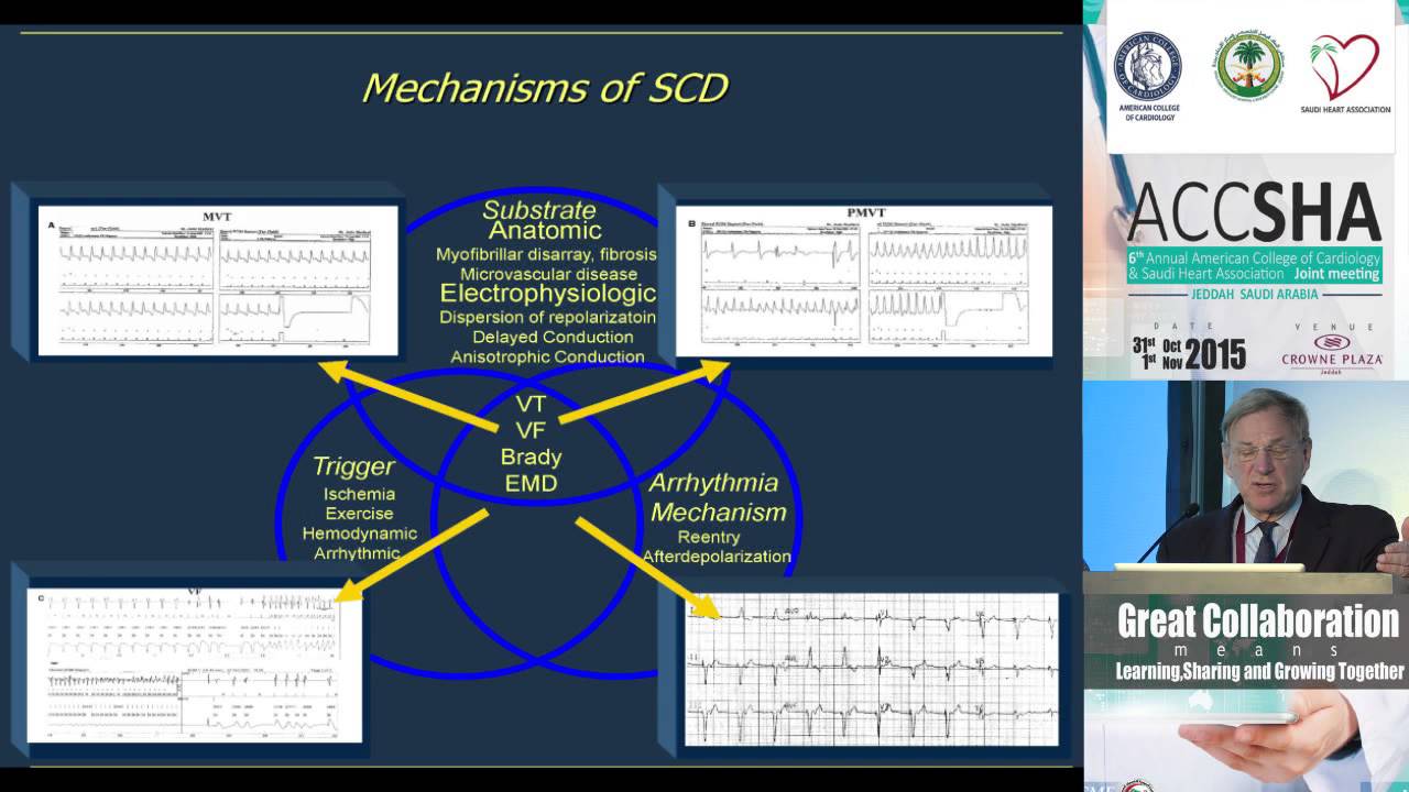 Mark Estes Risk Stratification of Sudden Cardiac Death
