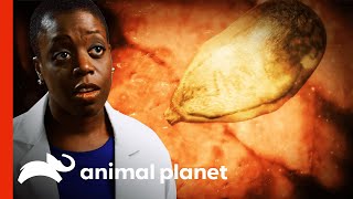 Parasite Eats Man's Lung Tissue | Monsters Inside Me