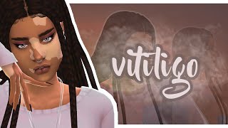 The Sims 4 | CAS | Создание персонажа | Витилиго