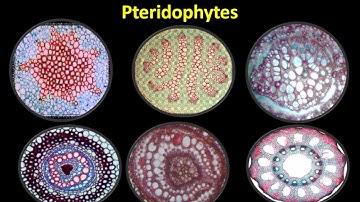 Types of Stele and its Evolution in Pteridophytes