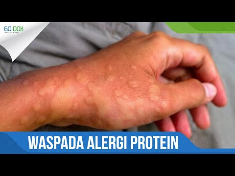 Video: Alergi Babi: Penyebab, Gejala, Diagnosis, Pengobatan, Dan Banyak Lagi