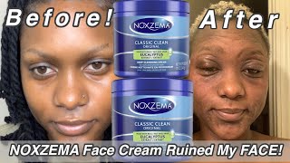 HOW NOXZEMA CREAM RUINED MY SKIN ( use with caution!!)| Skin Care Gone Wrong!| Aisha