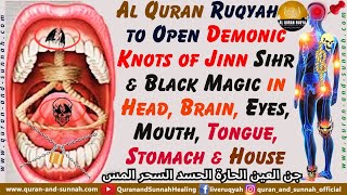 Ruqyah Shariah to Destroy Demonic Knots of Jinn Sihr & Magic in Head, Brain, Mouth, Tongue, Stomach.