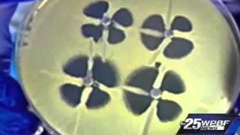 Dr. Dodson on Drug-Resistant Superbug