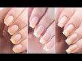 የተፈጥሮ ጥፍሬ በ7 ቀን ውስጥ ያሳደገልኝ|| WITH IN 7 Days Nails Growth Challenge|| Queen Zaii