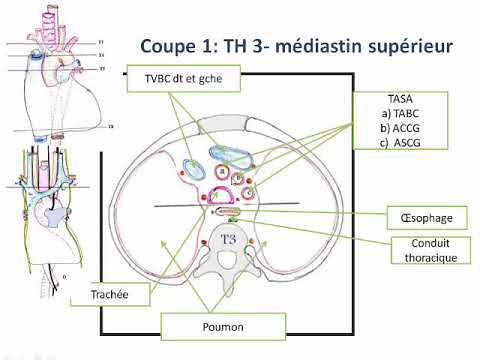 Vidéo: Fluide Dans La Cavité Thoracique Des Furets