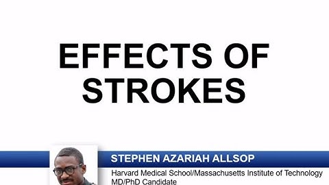 USMLE-Rx Express Video of the Week: Effects of Strokes