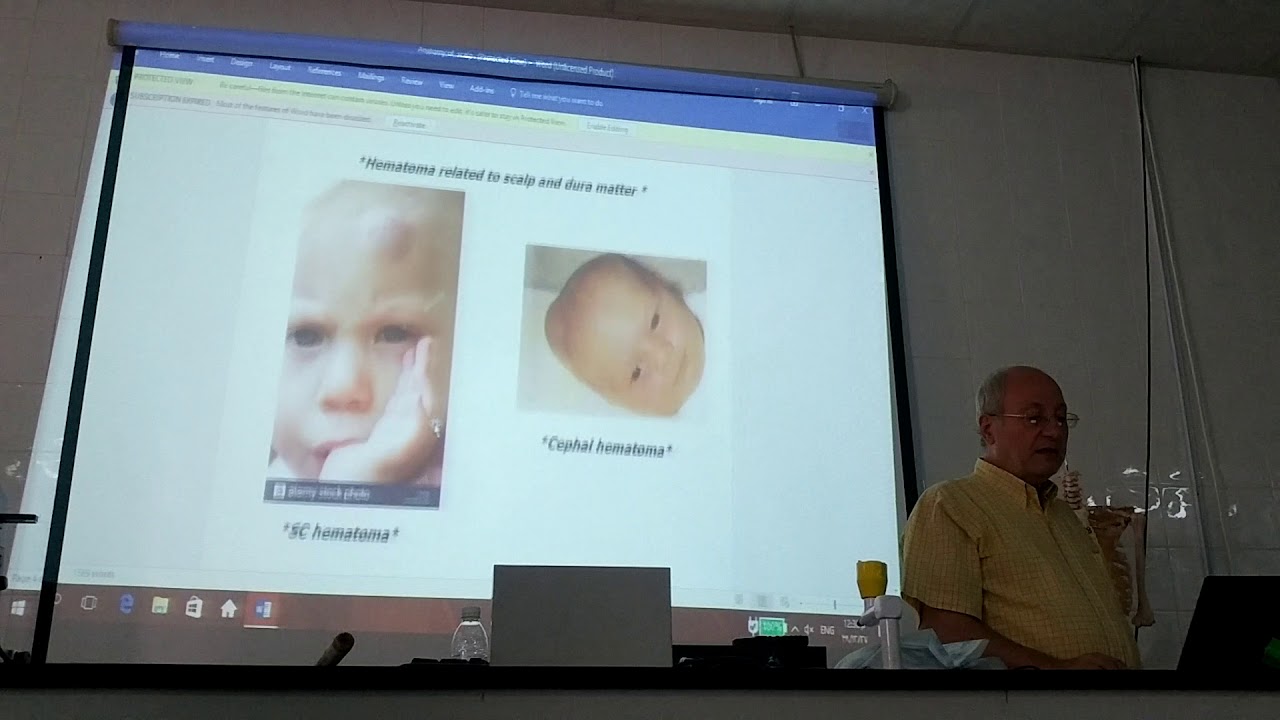 Anatomy of head & neck 20 ( Scalp  , part 1 ) , by Dr. Wahdan