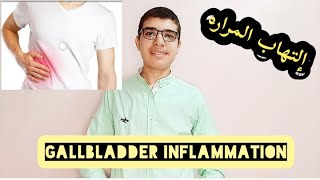 إلتهاب المراره