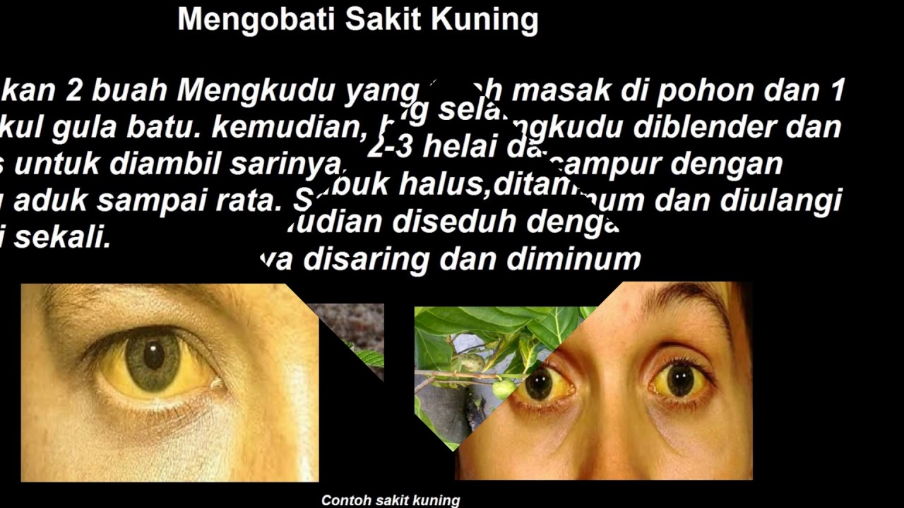 diabetes khasiat buah mengkudu diabetes khasiat buah mengkudu
