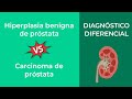 Hiperplasia benigna de próstata vs Carcinoma de próstata. Diagnóstico Diferencial