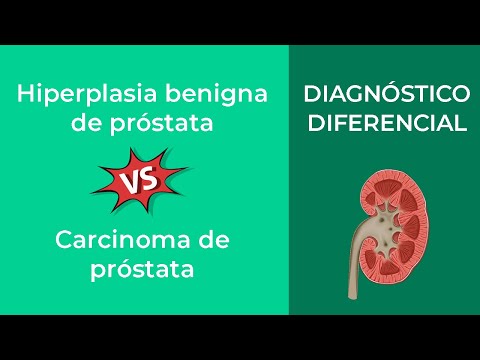 Vídeo: HPB Versus Cáncer De Próstata: ¿cuál Es La Diferencia?