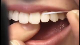 How To Floss Your Teeth By Mydentcart