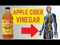 Top 10 Benefits of Apple Cider Vinegar You Never Knew