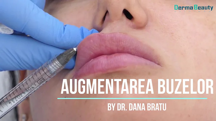 Augmentarea buzelor: workshop pentru medici / Dr. Dana Bratu