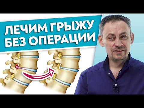 Как избавиться от протрузии навсегда? / Можно ли вылечить ГРЫЖУ без операции?