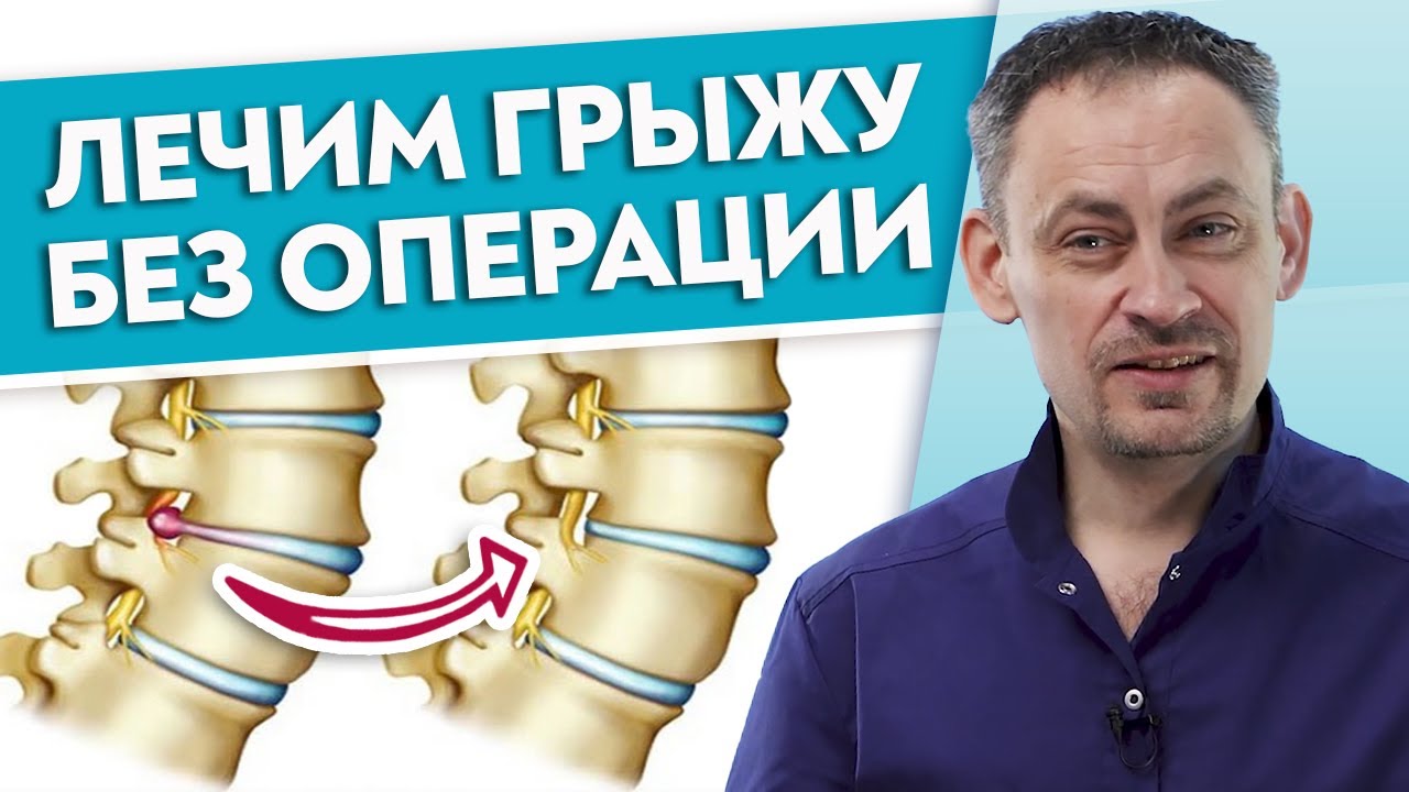 Как избавиться от протрузии навсегда? / Можно ли вылечить ГРЫЖУ без ...