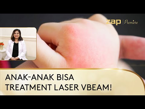 Video: Cara Mengobati Hemangioma Pada Anak