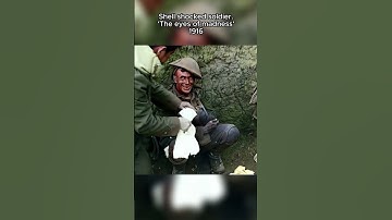 Colorized Footage: Shell shocked soldier, 1916 #ww1 #ai