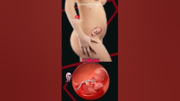 Pregnancy Week by Week 💕