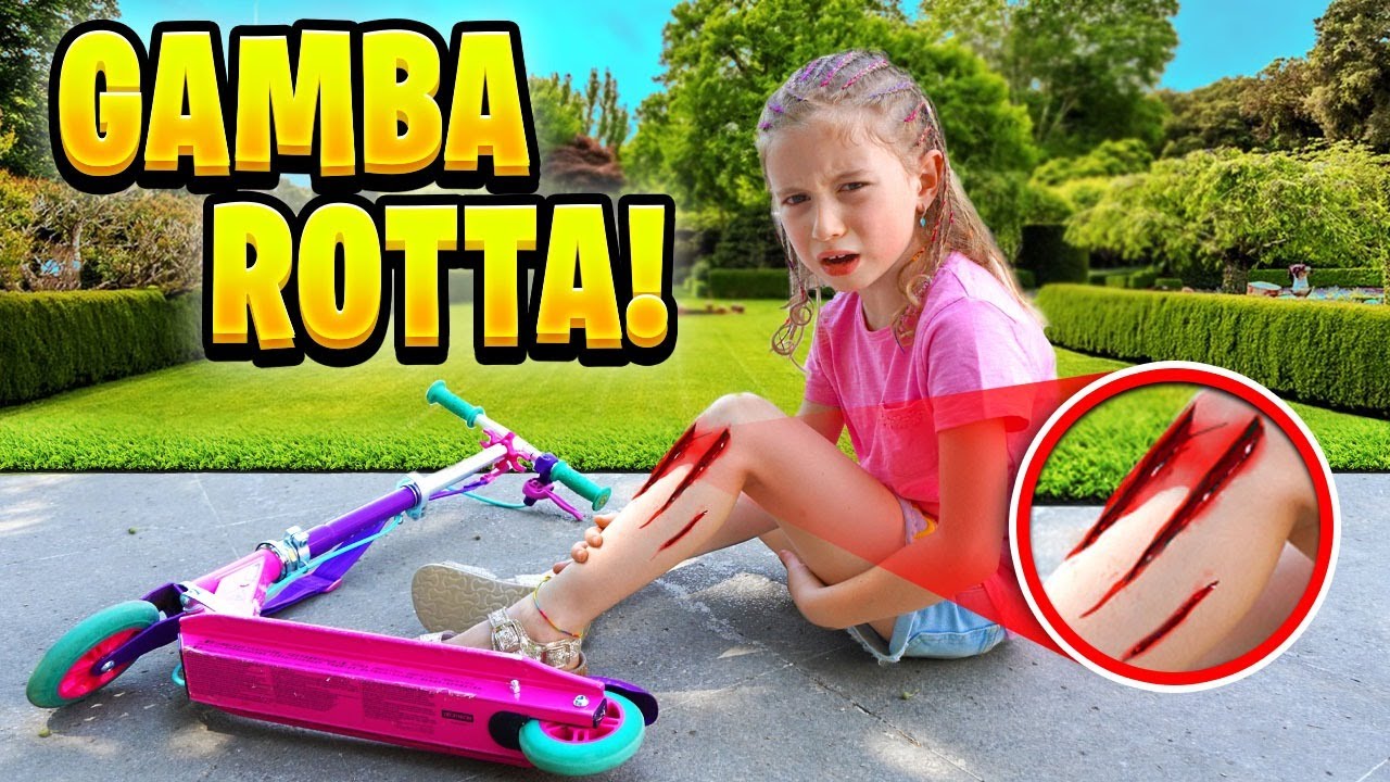 GIORGIA CADE SI FA MALE E SI ROMPE LA GAMBA MENTRE VA IN MONOPATTINO